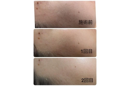 様々な薬剤の中から最適なものを選びます