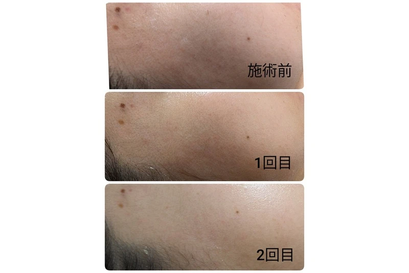 様々な薬剤の中から最適なものを選びます